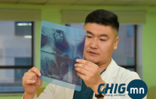 Д.Отгонбаатар: Хавар бөөлжүүлэг эмчилгээ хийхэд амны үнэр арилж, бие хөнгөрч, тунгалгийн галын илч сайжирдаг