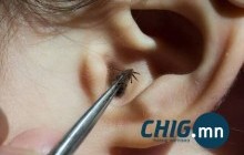 Чихэнд юм орвол чихийг доош харуулан толгойг хазайлгаж барина