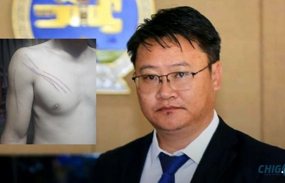 Дарьганга сумын Засаг дарга бусдын биед халдсан гэх гомдлыг шалгаж байна