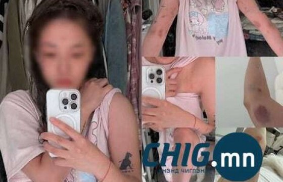 Солонгост “хамт хоноё” гэхэд нь татгалзсан Тайвань бүсгүйн биед халджээ   