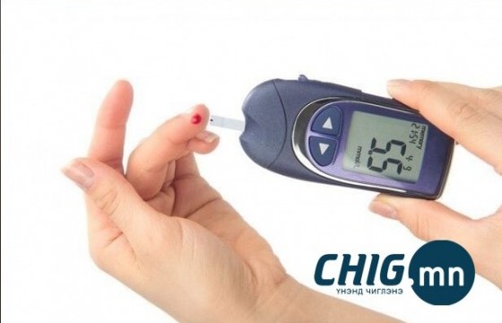 Чихрийн шижинтэй ажилтнуудын 32 хувь нь ажлын байрны сөрөг хандлагад өртдөг 