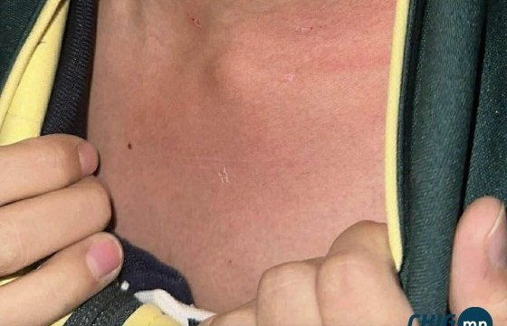 Өвөрмонголд сурдаг монгол хүүхдүүдийг багш нь зодсон хэрэг гарчээ