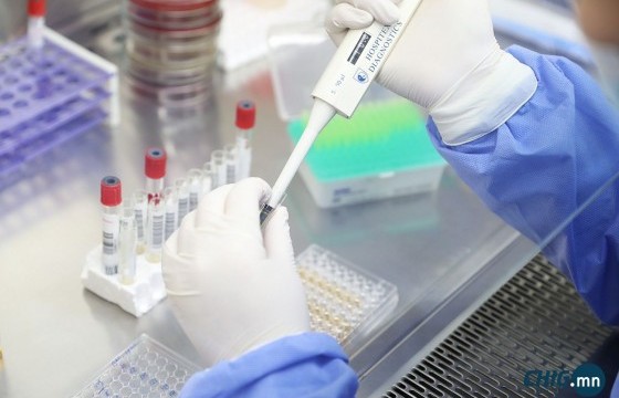 Хелико, сахар, үе мөч зэрэг 6 шинжилгээг үнэ төлбөргүй хийж эхэллээ 